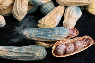 Muôn nẻo đường dẫn tới xơ gan ở Việt Nam