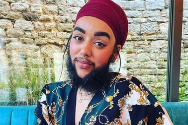 Cô gái có râu trở thành nhà hoạt động xã hội chống bắt nạt