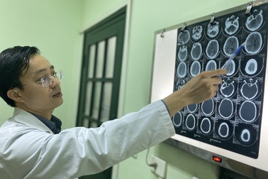 Nổ bình gas mini khi đang nấu ăn, người đàn ông mất đi bàn tay phải