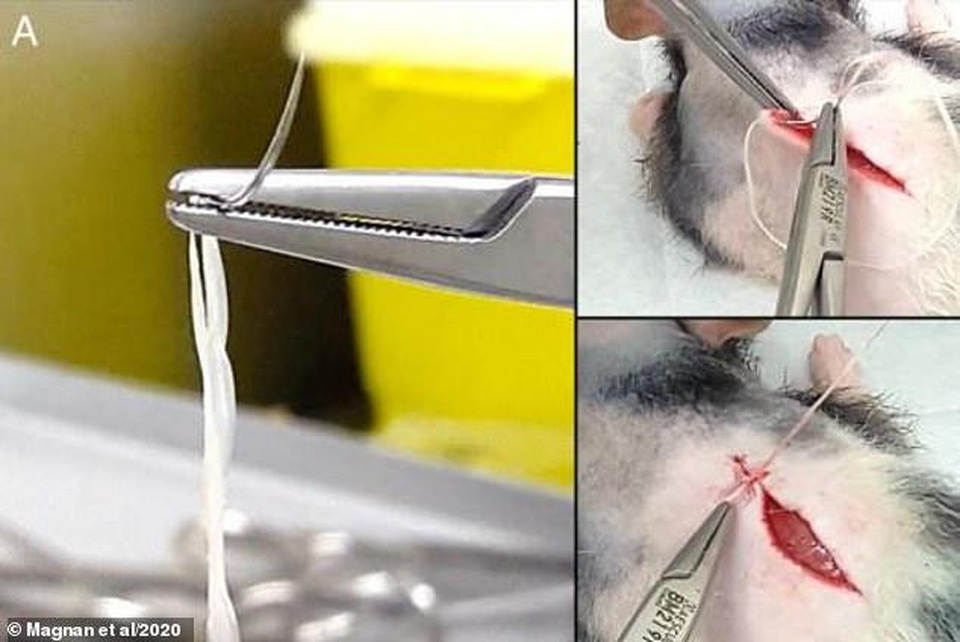Sợi được nuôi cấy từ tế bào da người có thể được dùng để ghép mô - 3 Sợi được nuôi cấy từ tế bào da người có thể được dùng để ghép mô - 3