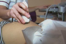 Phá thai 28 tuần tại phòng khám: Cô gái cấp cứu sốc mất máu nguy kịch