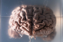 Thực hư việc biến đổi khí hậu làm teo não người