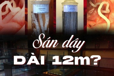 Độc lạ nơi lưu giữ những sinh vật dài hàng mét từng sống trong cơ thể người