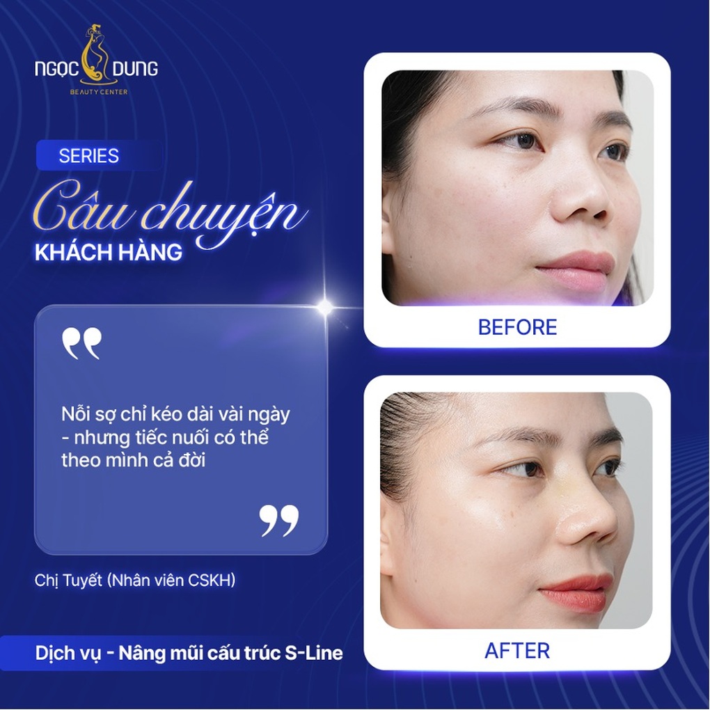 Hành trình vượt qua nỗi sợ dao kéo để chạm tới phiên bản hoàn thiện ở người trẻ - 2 Hành trình vượt qua nỗi sợ dao kéo để chạm tới phiên bản hoàn thiện ở người trẻ - 2