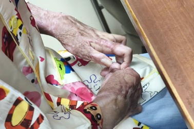 Thiếu nữ 17 tuổi bị bạn đốt keo nến làm cháy khắp người, phải mổ 15 lần