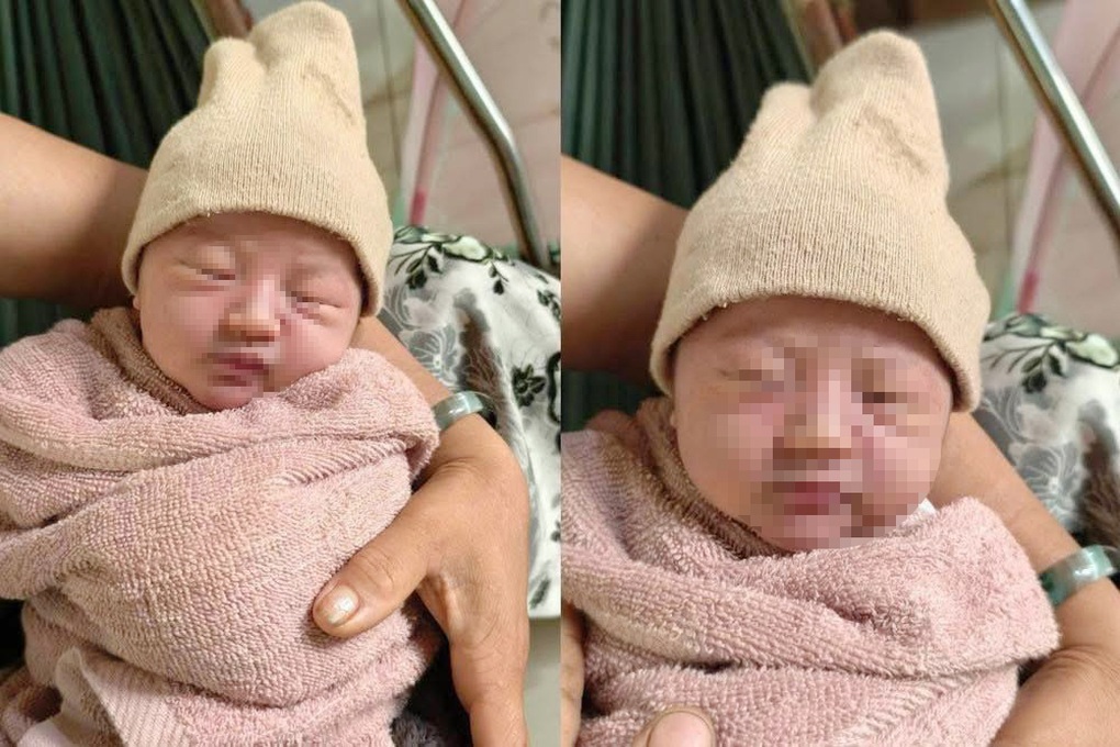 Bé gái sơ sinh được bọc trong túi nilon để trước nhà người dân ở Gia Lai - 1 Bé gái sơ sinh được bọc trong túi nilon để trước nhà người dân ở Gia Lai - 1