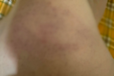 Công an vào cuộc vụ cô giáo bạo hành bé 3 tuổi