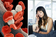 Dấu hiệu đột ngột vào buổi sáng cảnh báo bệnh máu trắng