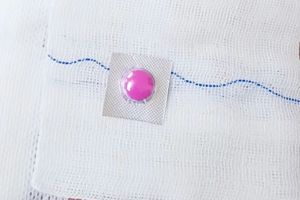 Thủng ruột suýt chết vì nuốt phải thứ không ngờ - 2 Thủng ruột suýt chết vì nuốt phải thứ không ngờ - 2