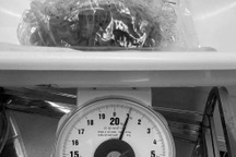 Sút 2kg trong 4 tháng, cô gái trẻ giật mình phát hiện u thận khổng lồ 1kg