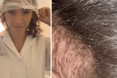 Người thợ làm tóc gây sửng sốt với clip giúp khách hàng xử lý... chấy