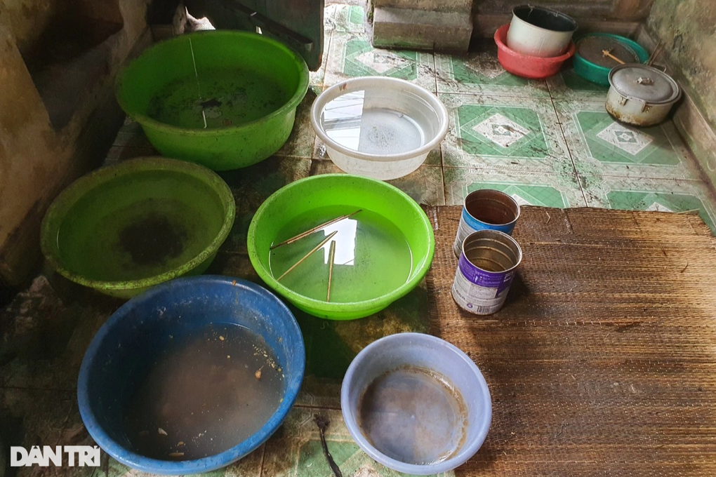 Nỗi thống khổ của người bệnh binh giữa Thủ đô thèm bữa cơm có thịt - 6 Nỗi thống khổ của người bệnh binh giữa Thủ đô thèm bữa cơm có thịt - 6