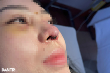 Vụ "bác sĩ tiktok" sửa mũi gây tai biến: Cơ sở thẩm mỹ hoạt động không phép