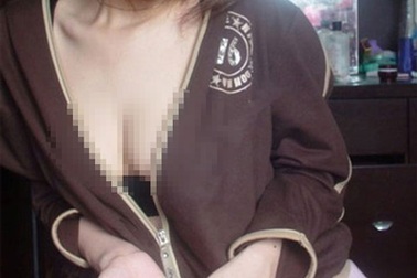 Khoái “lộ hàng” có phải bệnh?