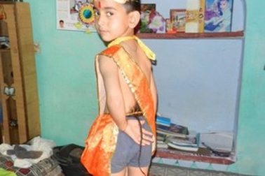 Bé 6 tuổi “mọc đuôi” được tôn thờ như thánh ở Ấn Độ 