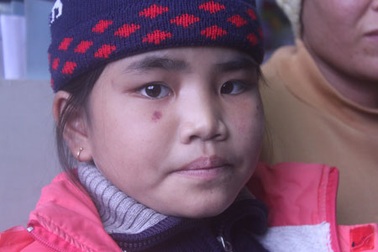 Tử thần rình rập sự sống của bé 9 tuổi mắc bệnh suy tủy nặng