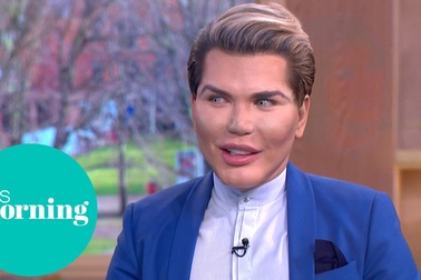 Rodrigo Alves mơ ước vẻ đẹp hoàn hảo