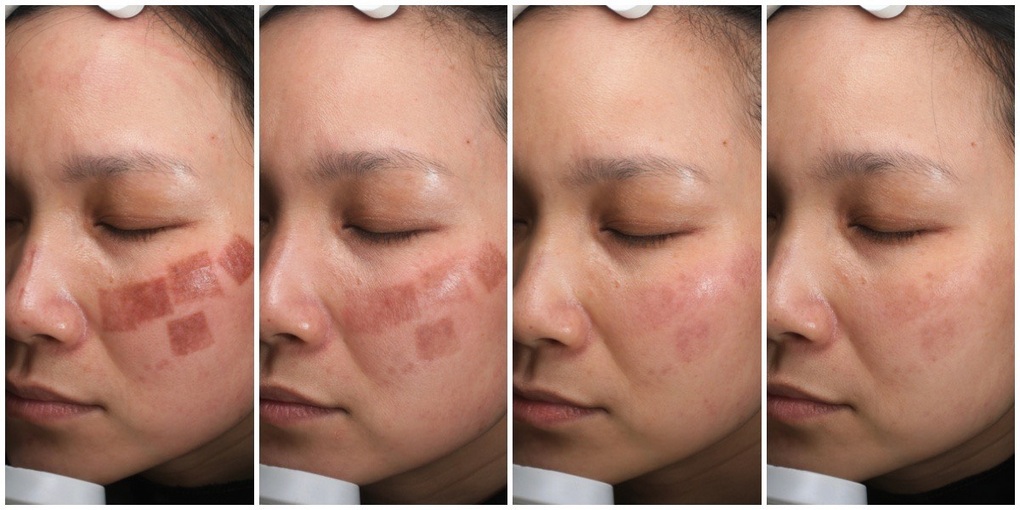 DRH Clinic được bình chọn Top 10 Thương hiệu uy tín quốc gia - 1 DRH Clinic được bình chọn Top 10 Thương hiệu uy tín quốc gia - 1
