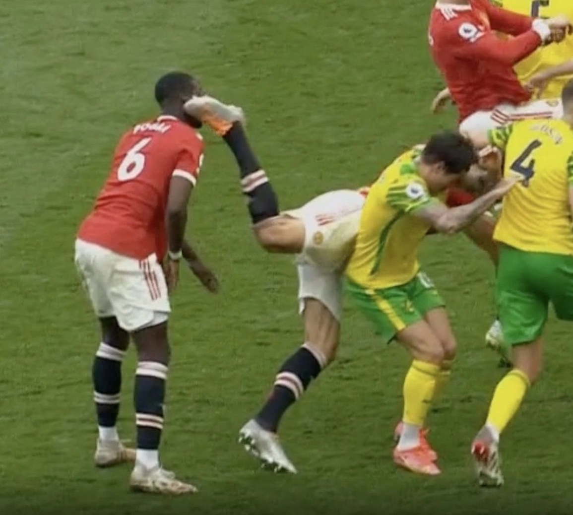 Paul Pogba nổi điên sau khi bị Harry Maguire đạp vào đầu - 1 Paul Pogba nổi điên sau khi bị Harry Maguire đạp vào đầu - 1