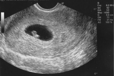 Khoảnh khắc đầu tiên mẹ nhìn rõ mặt con khi siêu âm 4D