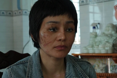 Vụ thai phụ bị bạo hành dã man: "Quay lại Hải Dương lúc này rất nguy hiểm!"