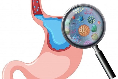 Scumar King - Hỗ trợ giảm triệu chứng viêm loét dạ dày, tá tràng hiệu quả