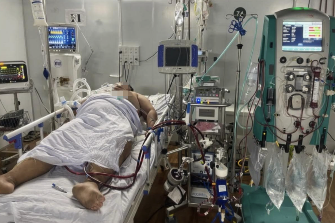 84 ngày chạy ECMO cứu thần kỳ F0 nặng 140kg, viện phí 1,6 tỷ đồng - 1 84 ngày chạy ECMO cứu thần kỳ F0 nặng 140kg, viện phí 1,6 tỷ đồng - 1