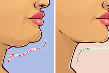 Tạm biệt tình trạng béo mặt, nọng cằm từ chính những thói quen hàng ngày