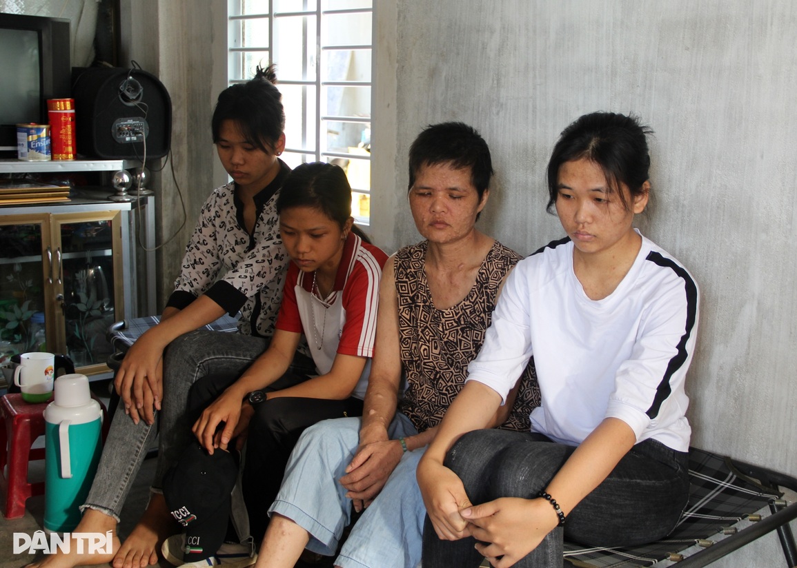 Người mẹ da cóc nuốt nước mắt chịu bệnh tật dày vò dành tiền học cho con - 5 Người mẹ da cóc nuốt nước mắt chịu bệnh tật dày vò dành tiền học cho con - 5