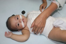 Bố mẹ sơ suất, bé 7 tháng tuổi gánh chịu tai nạn bỏng nước sôi nặng nề