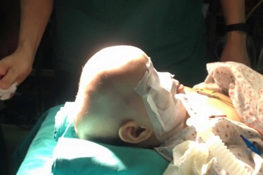 Bv Xanh Pôn: Phẫu thuật thành công hộp sọ biến dạng hình thuyền hiếm gặp cho bé 11 tháng tuổi