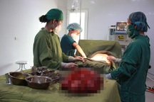 Đến viện với bụng như bầu 9 tháng, người phụ nữ được bóc khối u khổng lồ