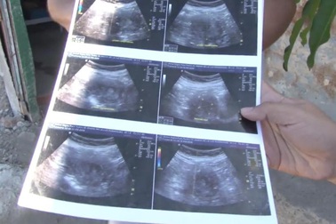 Cụ bà mang thai đứa con thứ 8 ở tuổi 70