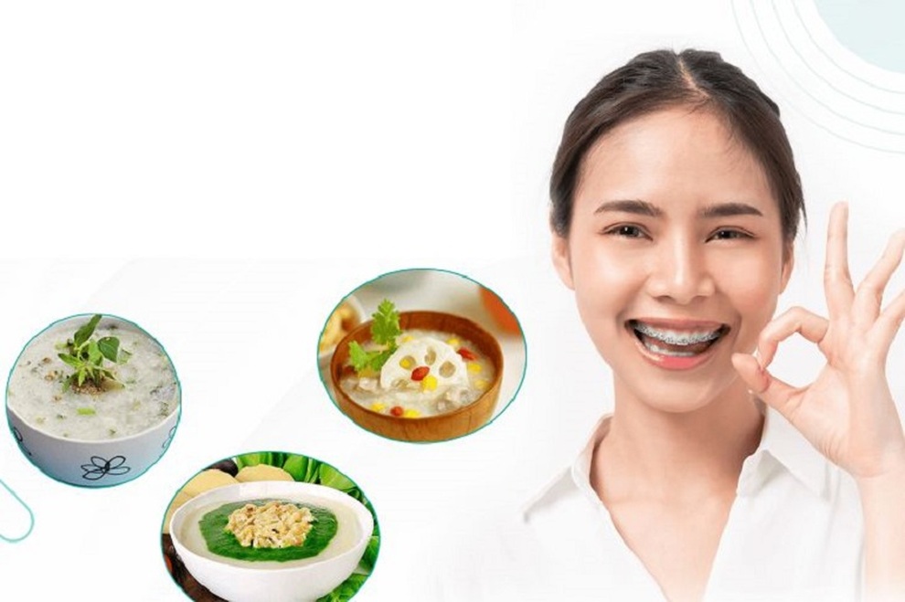 Sai lầm khi niềng răng nhiều người Việt mắc phải - 2 Sai lầm khi niềng răng nhiều người Việt mắc phải - 2