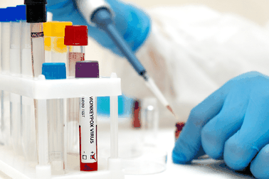 Thêm nước Đông Nam Á có đậu mùa khỉ, WHO nghi Ebola "tái xuất"