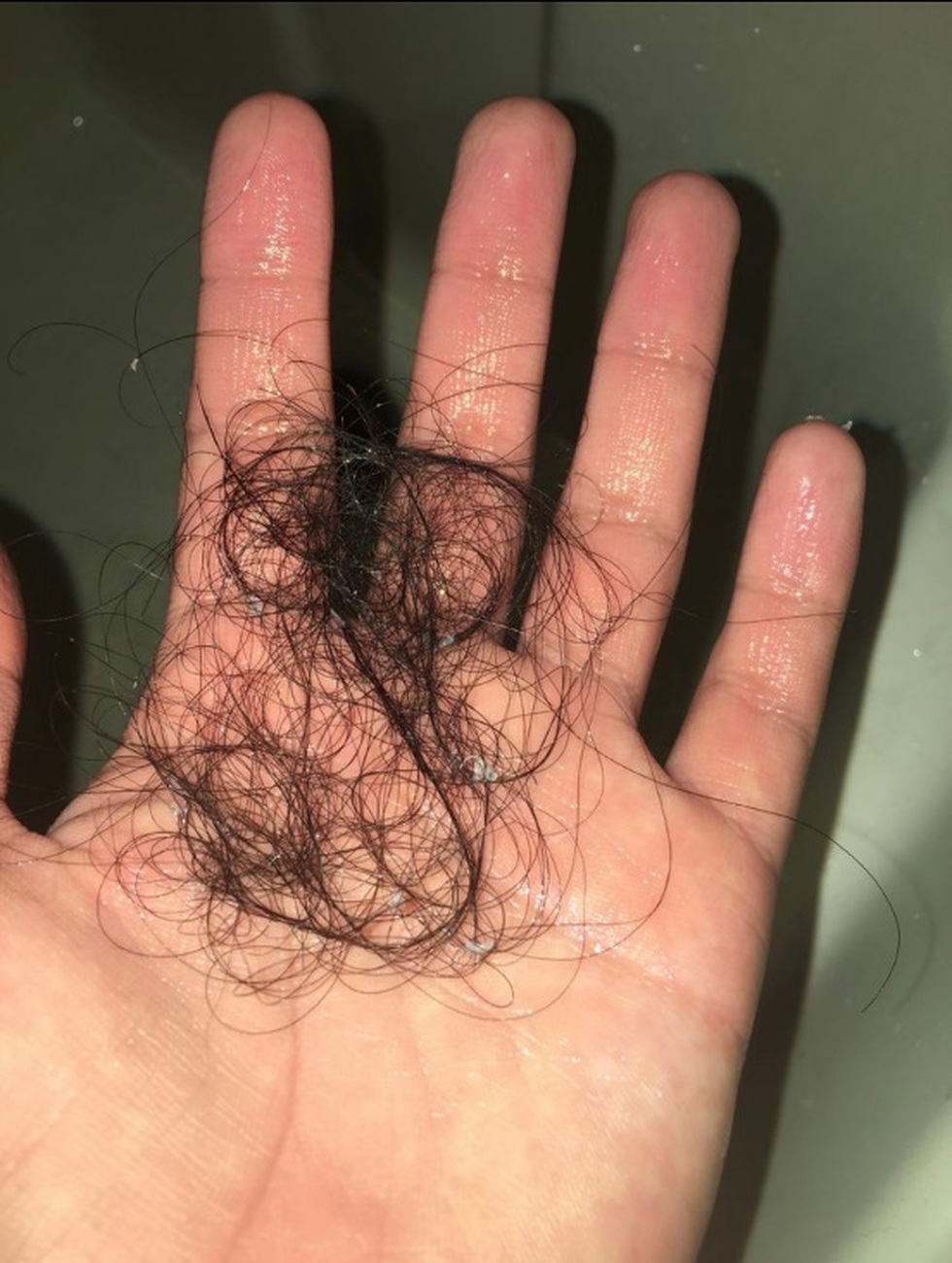 Gen Z giảm 30kg với một sợi dây và 3 bữa ăn/ngày - 5 Gen Z giảm 30kg với một sợi dây và 3 bữa ăn/ngày - 5