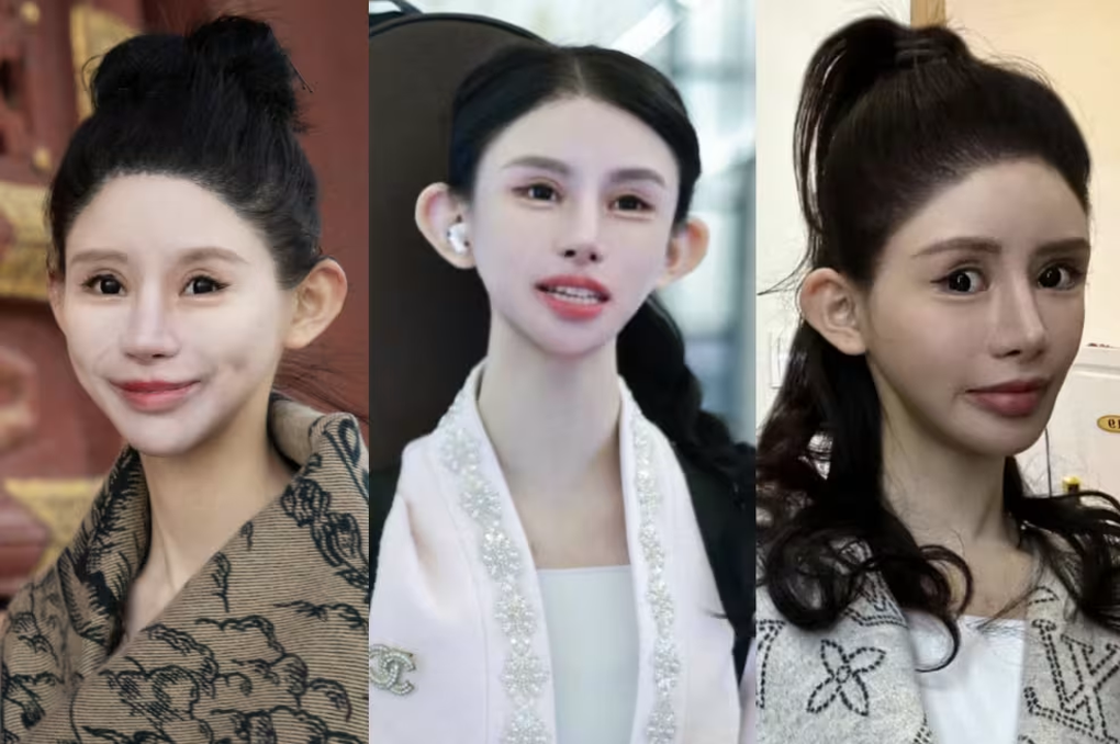 Nhan sắc khác lạ của hot girl Trung Quốc nghiện dao kéo từ năm 13 tuổi - 3