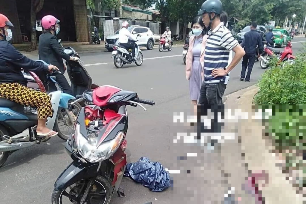 Bé gái thương tật 97% sau tai nạn: Khởi tố người giao xe máy - 1 Bé gái thương tật 97% sau tai nạn: Khởi tố người giao xe máy - 1
