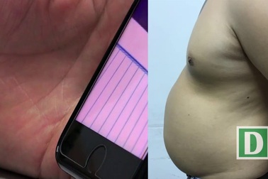 Tư vấn phẩu thuật thẩm mĩ qua điện thoại