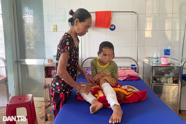Bố ruột trói chân, dùng rơm và xăng đốt con trai 7 tuổi