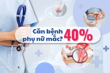 Nhận diện nhóm có nguy cơ cao mắc u xơ tử cung