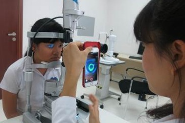 Ortho K - Điều chỉnh cận loạn thị không phẫu thuật