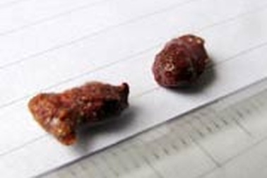 Xuất hiện vật lạ tự cháy trên bãi biển