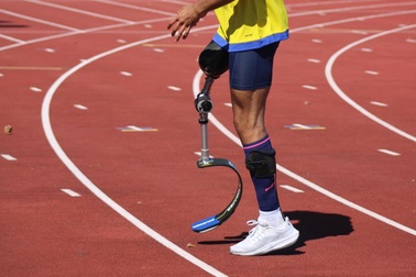 Cầu thủ bóng đá phải cắt chân vì căn bệnh hiểm dễ gây tử vong trong 24 giờ