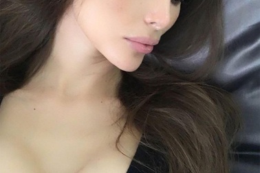 Mỹ nhân mang "cặp tuyết lê" hình vuông vì... phẫu thuật thẩm mỹ hỏng 10 năm trước