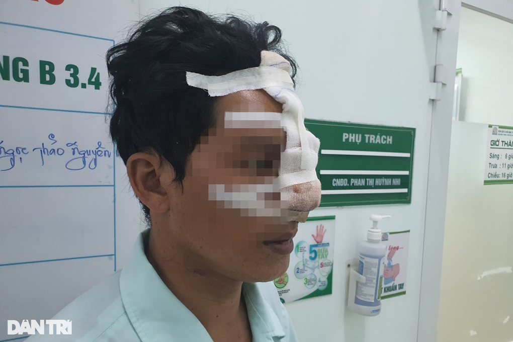 Người đàn ông 33 tuổi bị bạn nhậu cắn đứt mũi - 1 Người đàn ông 33 tuổi bị bạn nhậu cắn đứt mũi - 1