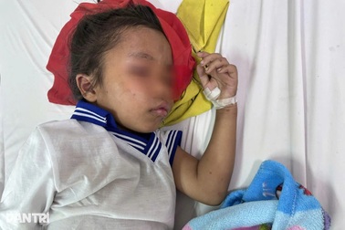 Theo bố mẹ lên rẫy, bé gái bị ong đốt 200 vết trên cơ thể