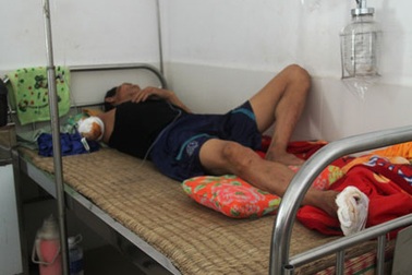 Công nhân đường sắt bị tàu gạt đứt lìa cánh tay 