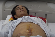 Bệnh nhân bị tái viêm ruột thừa do bác sĩ tuyến trước... mổ sót