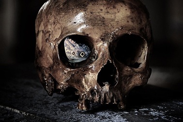 Cấy ghép đầu người sẽ trở thành hiện thực vào năm 2030